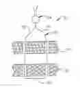 Fig. 01 - Method and device for securing body tissue