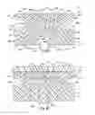 Fig. 19 - Method and device for securing body tissue