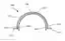 Fig. 01 - Endoscopic staples including anchorage mechanisms