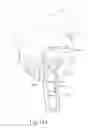 Fig. 17 - Surgical clip applier with articulation section