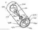 Fig. 01 - Spring for moveable jaws of device and delivery system for releasing therapeutic appliance