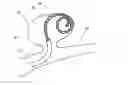 Fig. 01 - DEVICE AND METHOD FOR ENDOVASCULAR TREATMENT OF ANEURYSMS USING EMBOLIC ePTFE