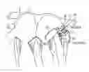 Fig. 01 - Apparatus and method for treating bleeding arising from left atrial appendage