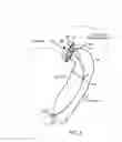 Fig. 09 - Apparatus and method for treating bleeding arising from left atrial appendage