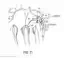 Fig. 12 - Apparatus and method for treating bleeding arising from left atrial appendage