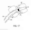 Fig. 18 - Apparatus and method for treating bleeding arising from left atrial appendage