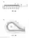 Fig. 19 - Apparatus and method for treating bleeding arising from left atrial appendage
