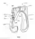 Fig. 25 - Clamping device for reducing venous blood flow