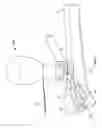 Fig. 04 - Apparatus and methods for bone access and cavity preparation