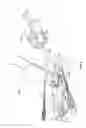 Fig. 10 - Apparatus and methods for bone access and cavity preparation
