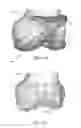 Fig. 05 - Adaptive surface surgical guiding apparatus and systems and methods of manufacturing adaptive surface surgical guiding apparatus