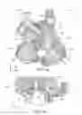 Fig. 07 - Adaptive surface surgical guiding apparatus and systems and methods of manufacturing adaptive surface surgical guiding apparatus