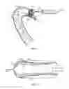 Fig. 02 - Perfusion catheters and related methods