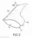 Fig. 03 - Devices and methods for removal of calculus