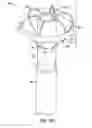 Fig. 22 - VESSEL OCCLUDING MATERIAL EXTRACTOR