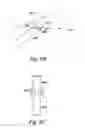 Fig. 23 - VESSEL OCCLUDING MATERIAL EXTRACTOR