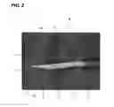 Fig. 03 - Edged medical cutting tool