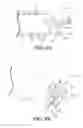 Fig. 12 - Tumor debulker