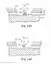 Fig. 16 - Method for resection of tumors and tissues