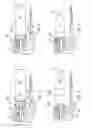 Fig. 04 - Tissue removal device with adjustable sleeve for neurosurgical and spinal surgery applications