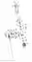 Fig. 07 - Tissue removal device with adjustable sleeve for neurosurgical and spinal surgery applications