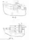 Fig. 09 - Tissue removal device with adjustable sleeve for neurosurgical and spinal surgery applications