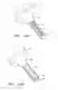 Fig. 18 - Adjustable cannula systems and devices