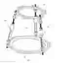 Fig. 02 - External fixation system