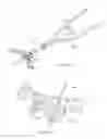 Fig. 28 - External fixation system
