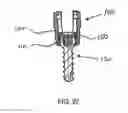 Fig. 14 - Polyaxial screw