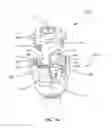 Fig. 22 - Polyaxial screw