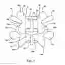 Fig. 02 - Systems and methods for posterior dynamic stabilization of the spine