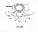 Fig. 04 - Systems and methods for posterior dynamic stabilization of the spine
