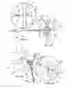 Fig. 09 - Systems and methods for posterior dynamic stabilization of the spine