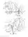 Fig. 10 - Systems and methods for posterior dynamic stabilization of the spine
