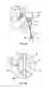Fig. 11 - Systems and methods for posterior dynamic stabilization of the spine