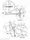Fig. 13 - Systems and methods for posterior dynamic stabilization of the spine