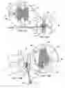 Fig. 14 - Systems and methods for posterior dynamic stabilization of the spine