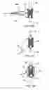 Fig. 17 - Systems and methods for posterior dynamic stabilization of the spine