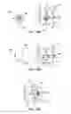 Fig. 19 - Systems and methods for posterior dynamic stabilization of the spine