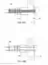 Fig. 23 - Systems and methods for posterior dynamic stabilization of the spine