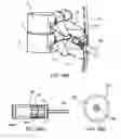 Fig. 31 - Systems and methods for posterior dynamic stabilization of the spine