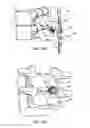Fig. 34 - Systems and methods for posterior dynamic stabilization of the spine