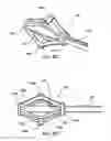 Fig. 40 - Systems and methods for posterior dynamic stabilization of the spine