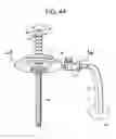 Fig. 05 - Proximal-end securement of a minimally invasive working channel