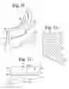 Fig. 07 - TOWER TOOL FOR MINIMALLY INVASIVE SURGERY