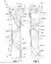 Fig. 02 - BONE FIXATION APPARATUS