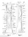 Fig. 03 - BONE FIXATION APPARATUS