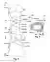 Fig. 04 - BONE FIXATION APPARATUS