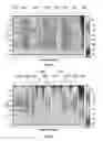 Fig. 05 - Bone cement removal using real-time acoustic feedback